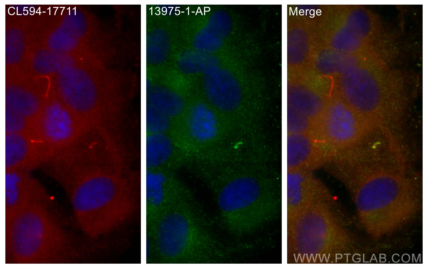 IF Staining of hTERT-RPE1 using 13975-1-AP