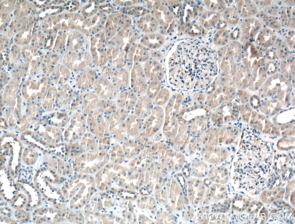 IHC staining of human kidney using 13975-1-AP