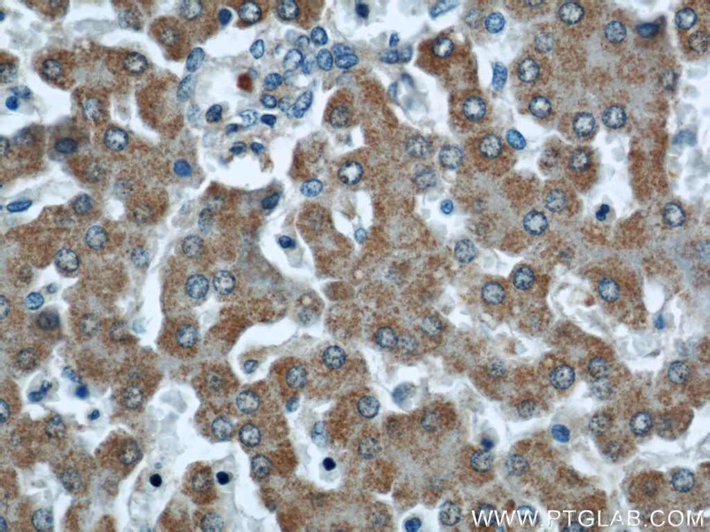 IHC staining of human liver using 60195-1-Ig (same clone as 60195-1-PBS)