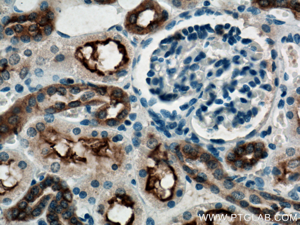 IHC staining of human kidney using 28049-1-AP