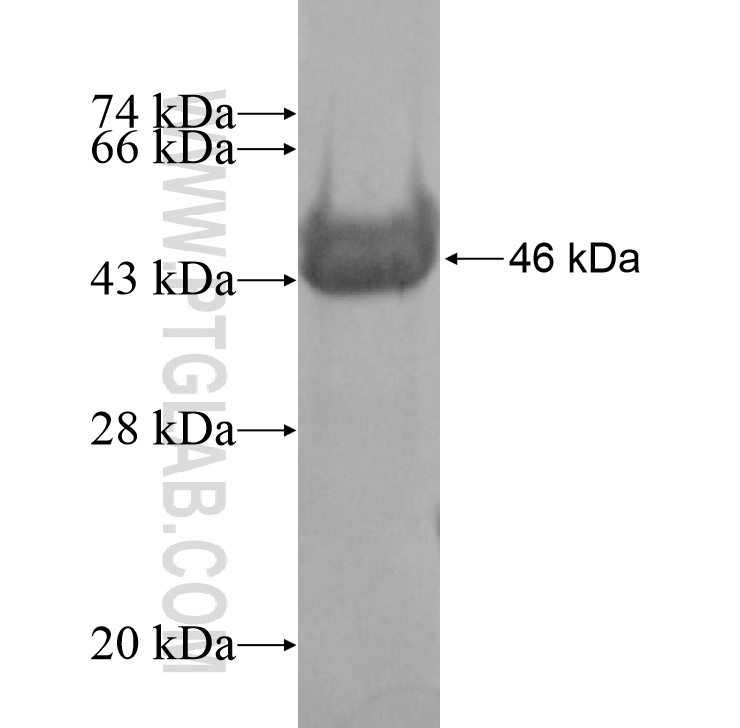 TMEM79 fusion protein Ag14788 SDS-PAGE