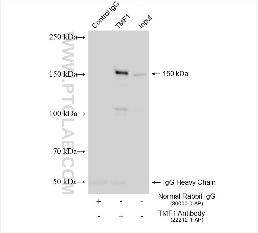 IP experiment of mouse brain using 22212-1-AP