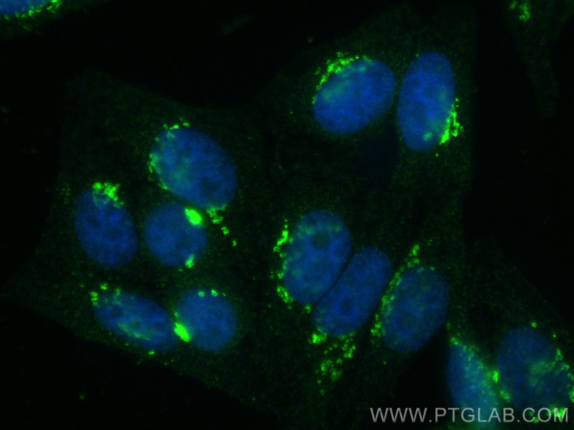 IF Staining of HepG2 using 67505-1-Ig