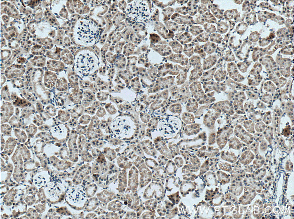 IHC staining of mouse kidney using 27174-1-AP