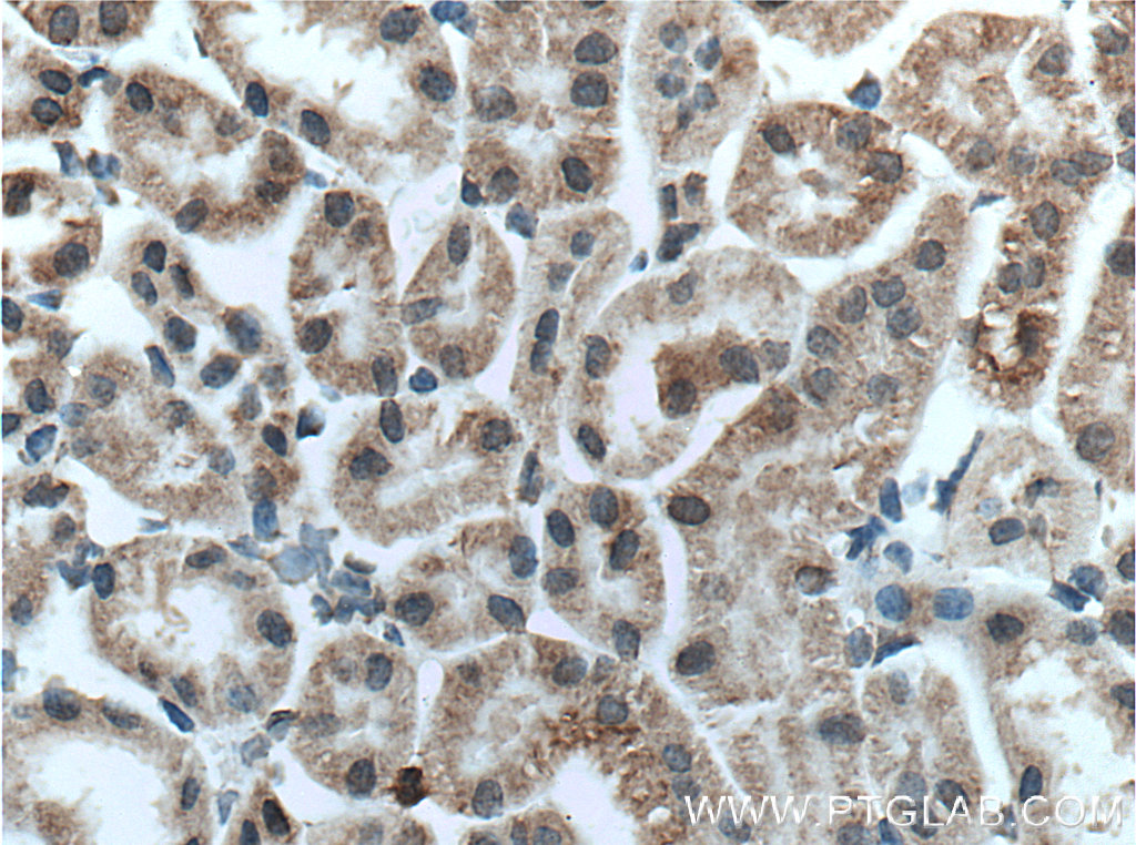 IHC staining of mouse kidney using 27174-1-AP