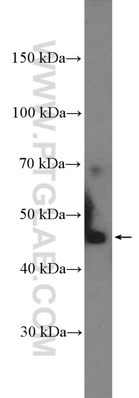 WB analysis of mouse kidney using 27174-1-AP