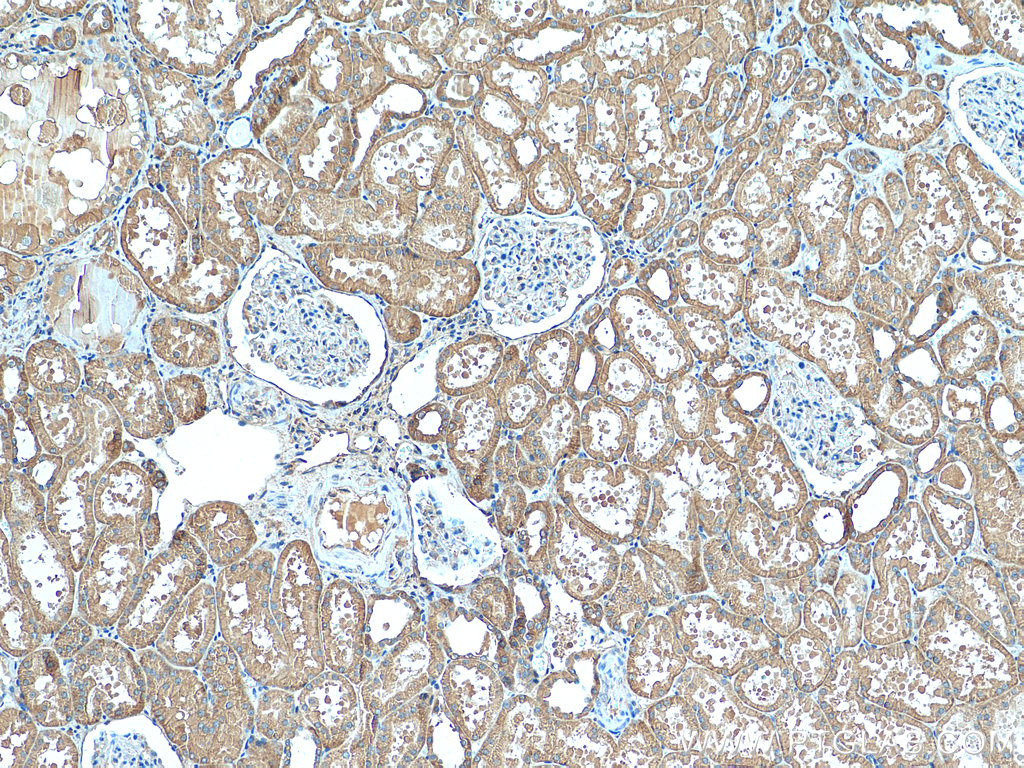 IHC staining of human kidney using 12521-1-AP