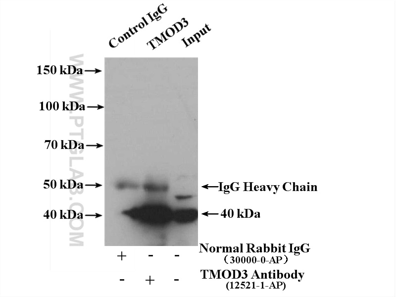 IP experiment of Jurkat using 12521-1-AP