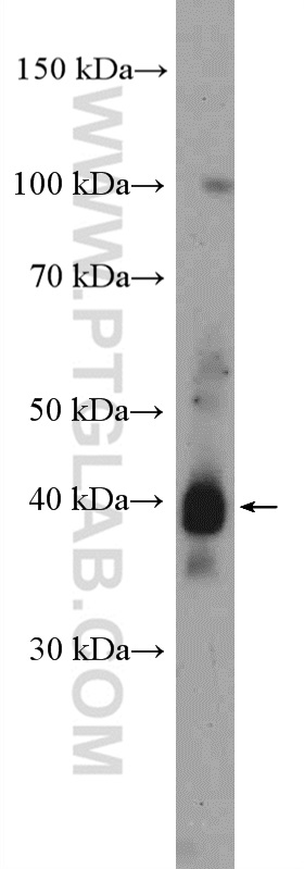 WB analysis of mouse skin using 17953-1-AP