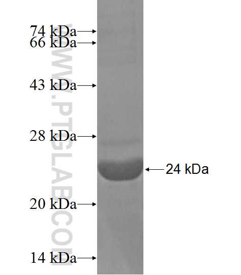 TMX2 fusion protein Ag13943 SDS-PAGE