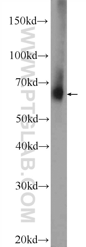 WB analysis of mouse brain using 21040-1-AP