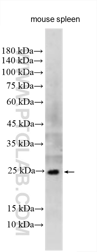 WB analysis of mouse spleen using 31505-1-AP