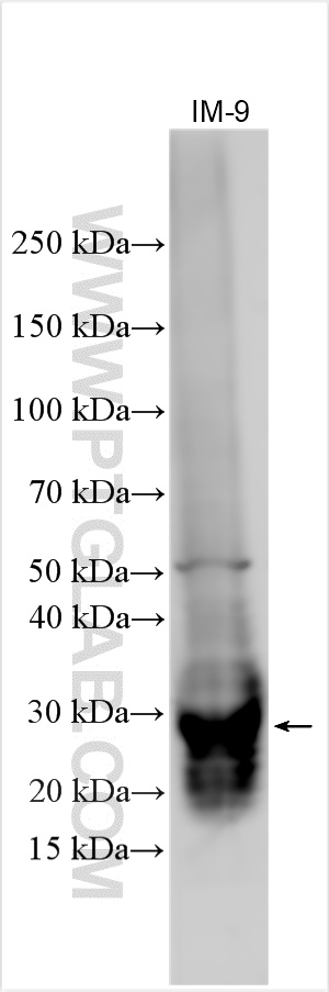 WB analysis using 21520-1-AP