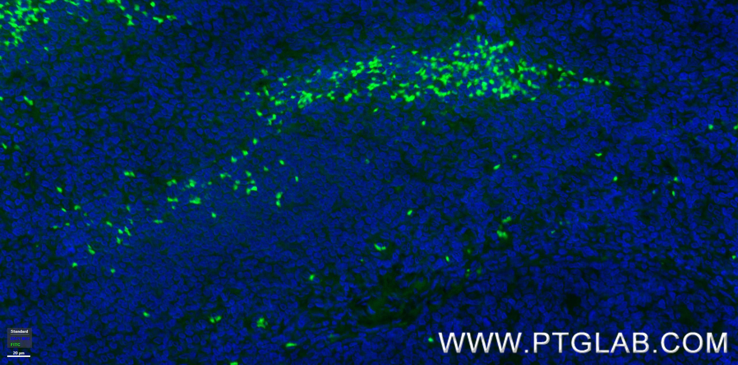 IF Staining of human tonsillitis using 98112-1-RR (same clone as 98112-1-PBS)