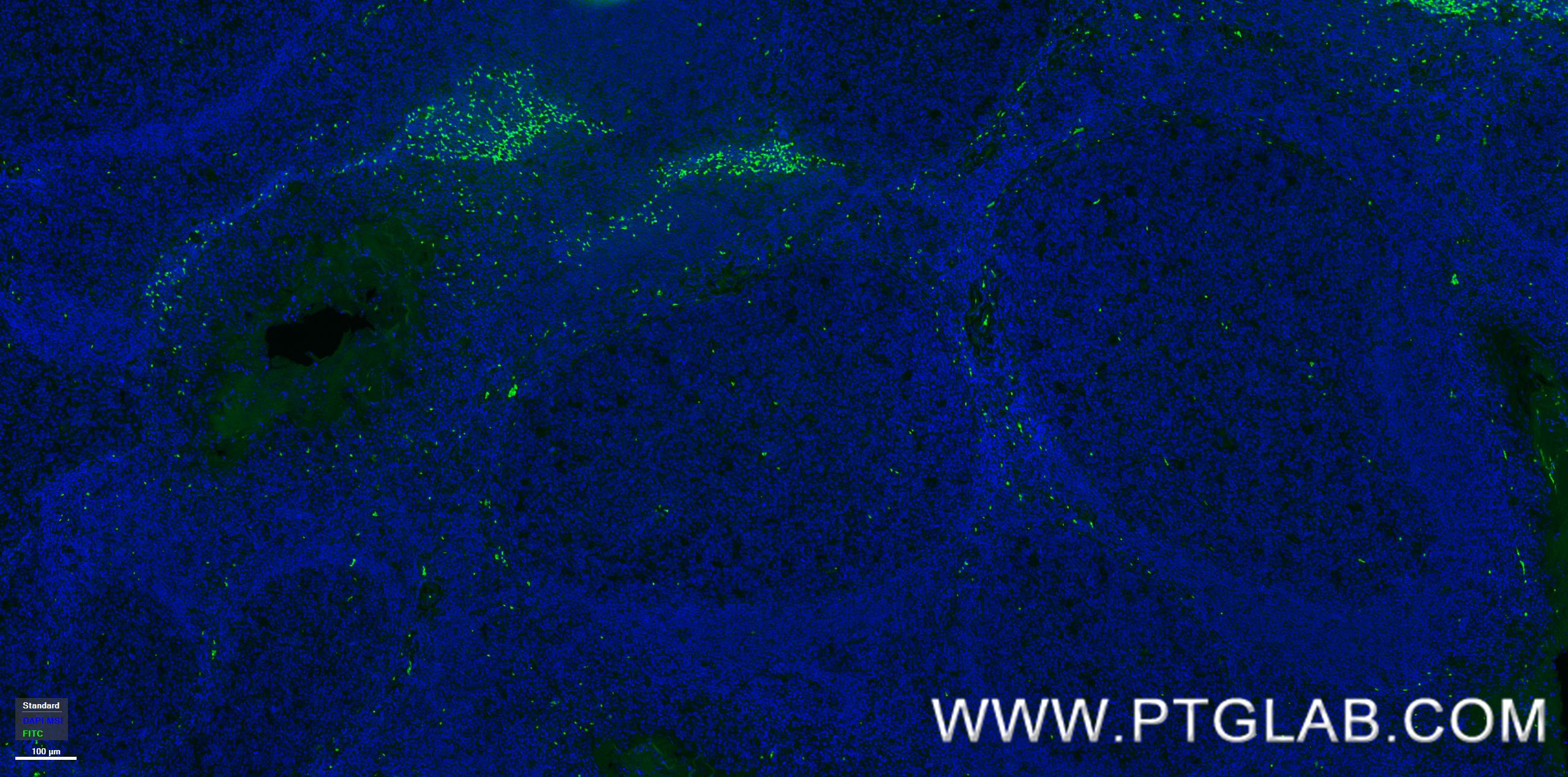 IF Staining of human tonsillitis using 98112-1-RR (same clone as 98112-1-PBS)