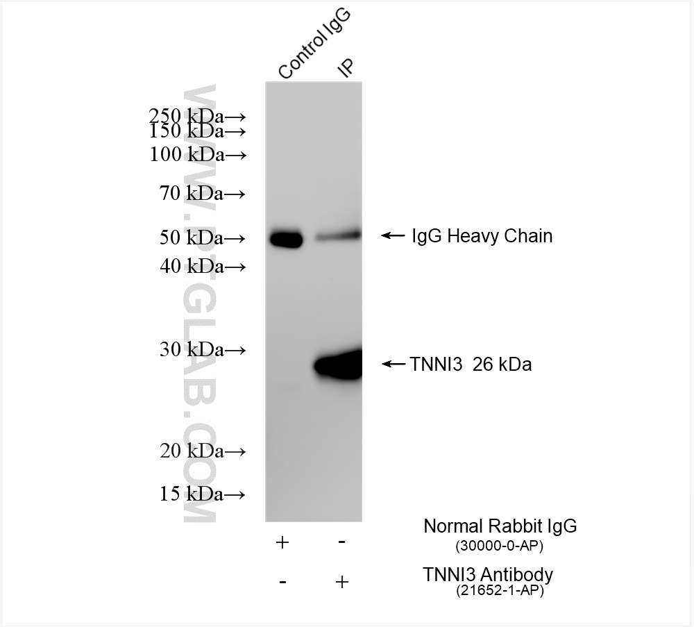 IP experiment of mouse heart using 21652-1-AP