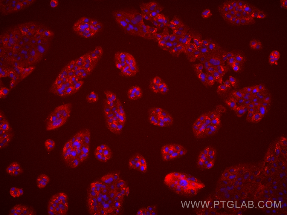 IF Staining of hTERT-RPE1 using 68631-1-Ig (same clone as 68631-1-PBS)