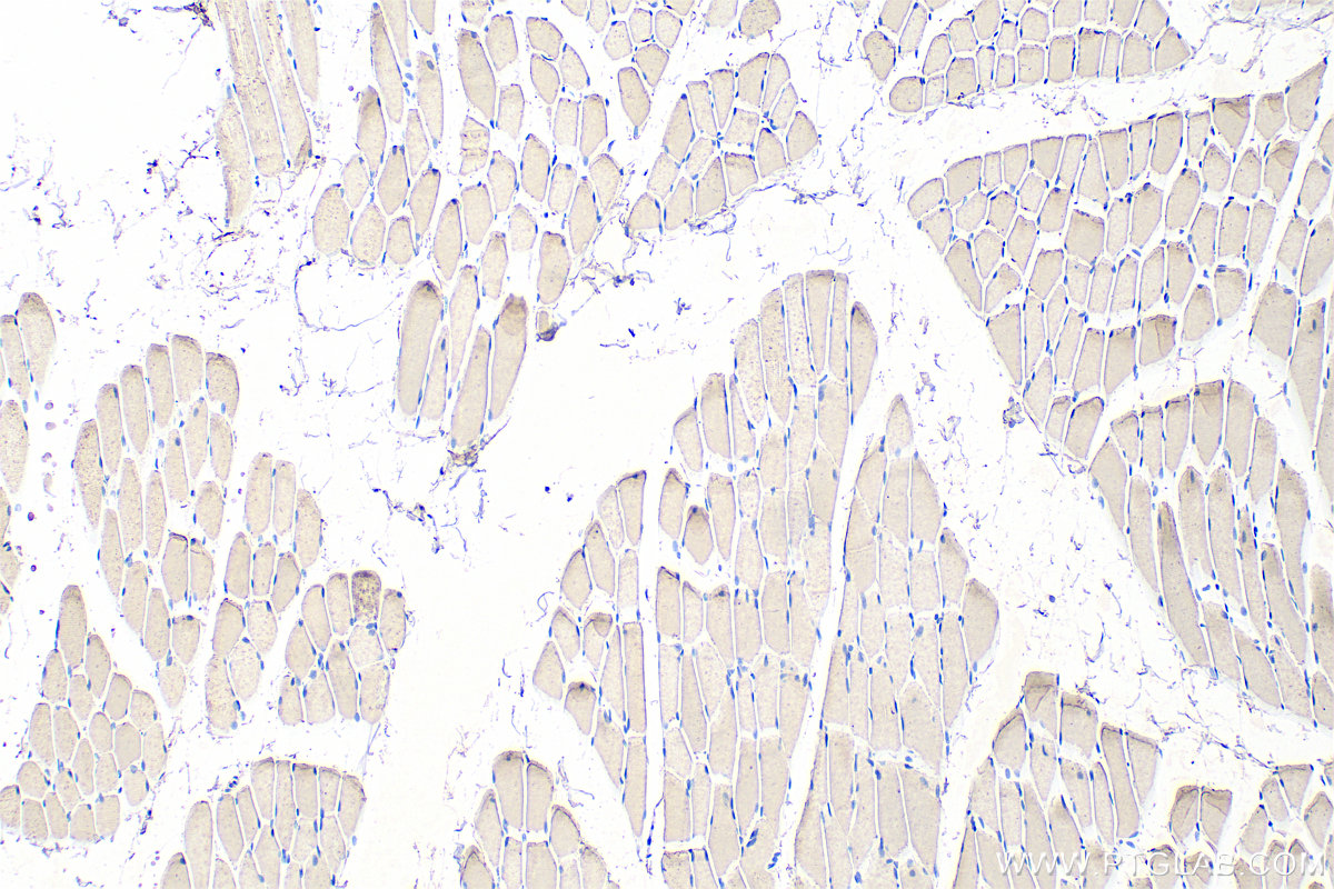 IHC staining of rat skeletal muscle using 68631-1-Ig (same clone as 68631-1-PBS)