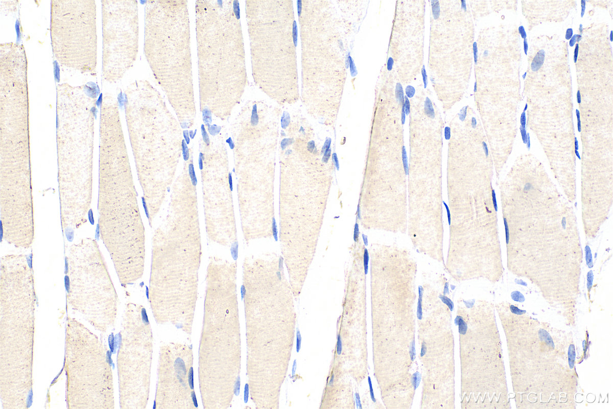 IHC staining of rat skeletal muscle using 68631-1-Ig (same clone as 68631-1-PBS)