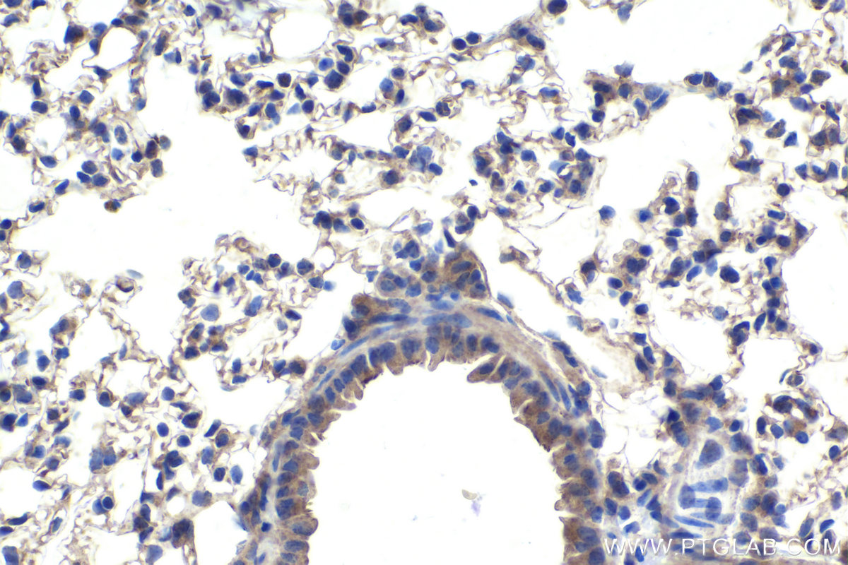 IHC staining of mouse lung using 20679-1-AP