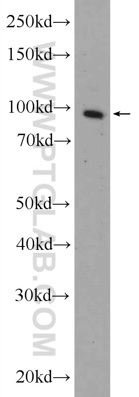 WB analysis of HeLa using 20679-1-AP