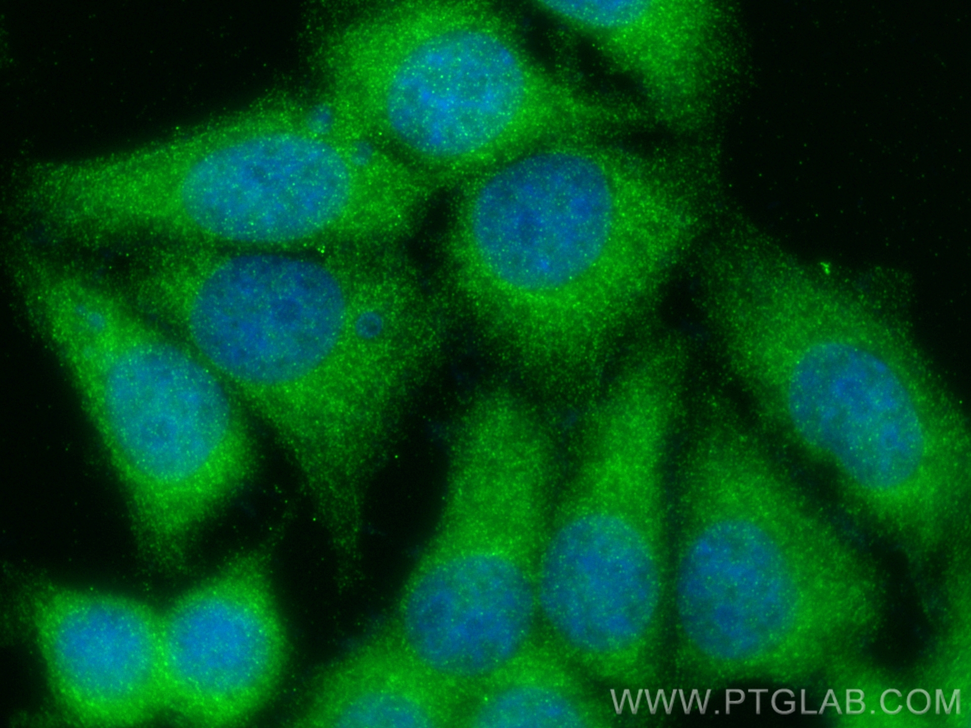 IF Staining of MCF-7 using 17831-1-AP