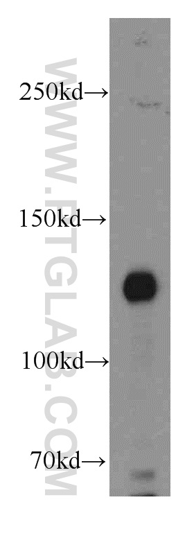 WB analysis of mouse kidney using 20053-1-AP