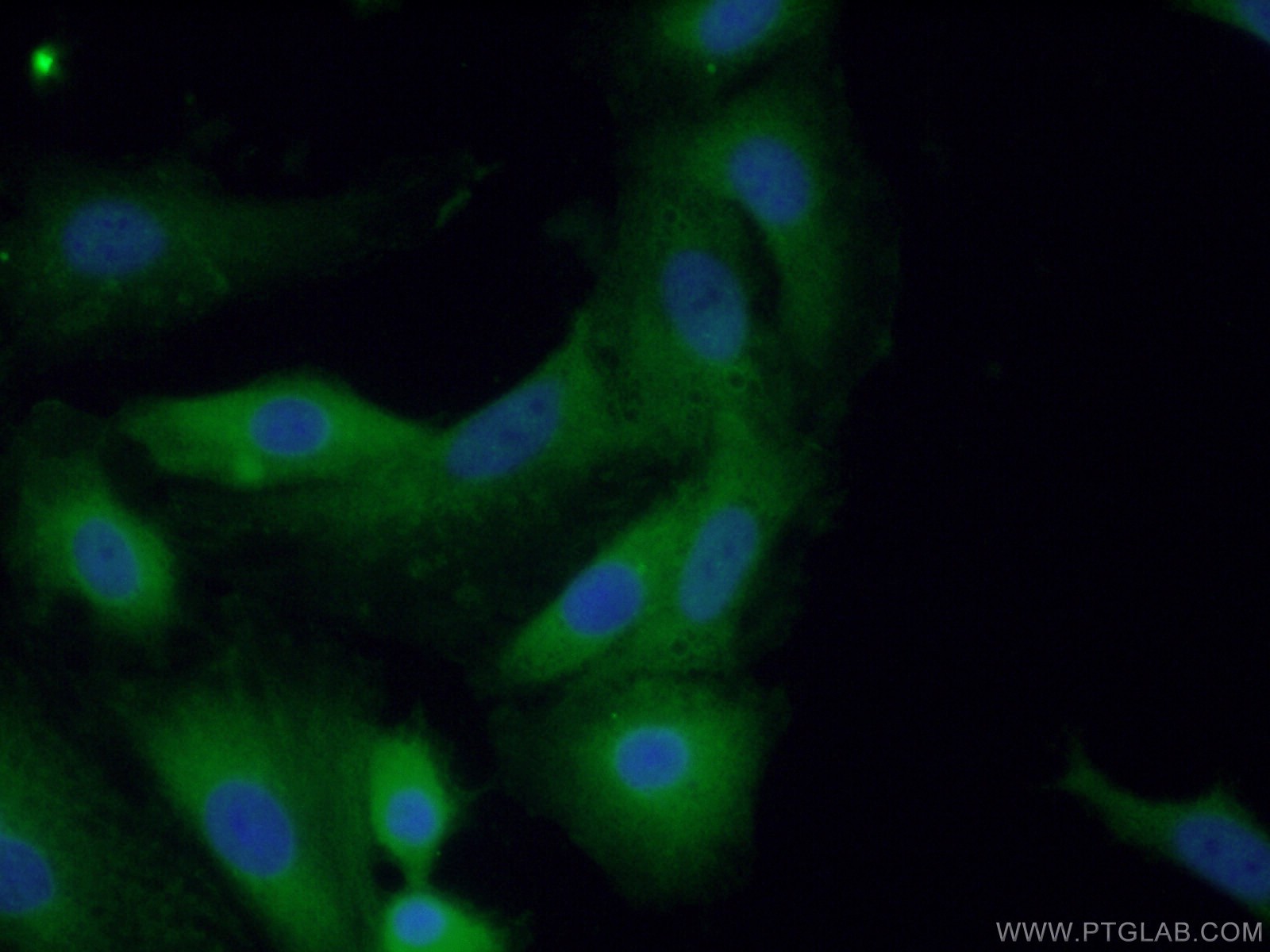 IF Staining of A549 using 11580-1-AP