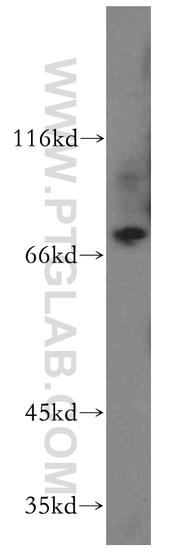 WB analysis of human placenta using 11580-1-AP (same clone as 11580-1-PBS)