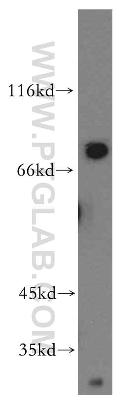 WB analysis of mouse liver using 13595-1-AP