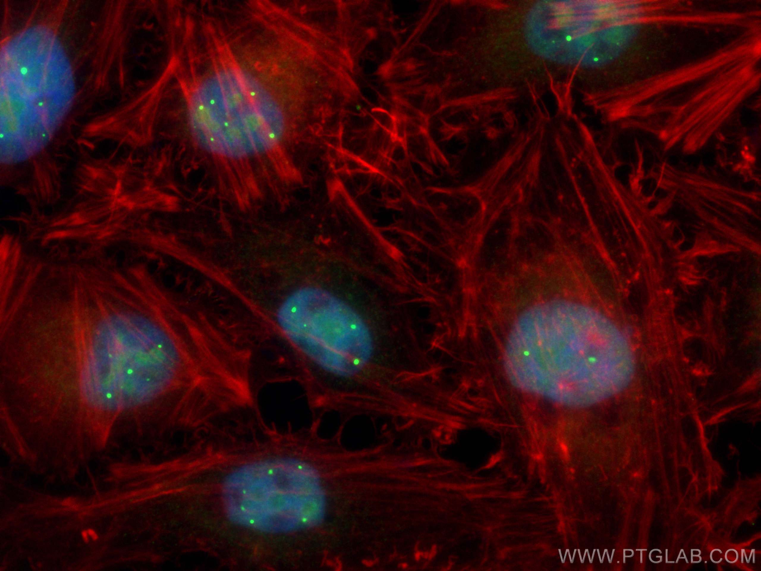 IF Staining of HeLa using 16203-1-AP