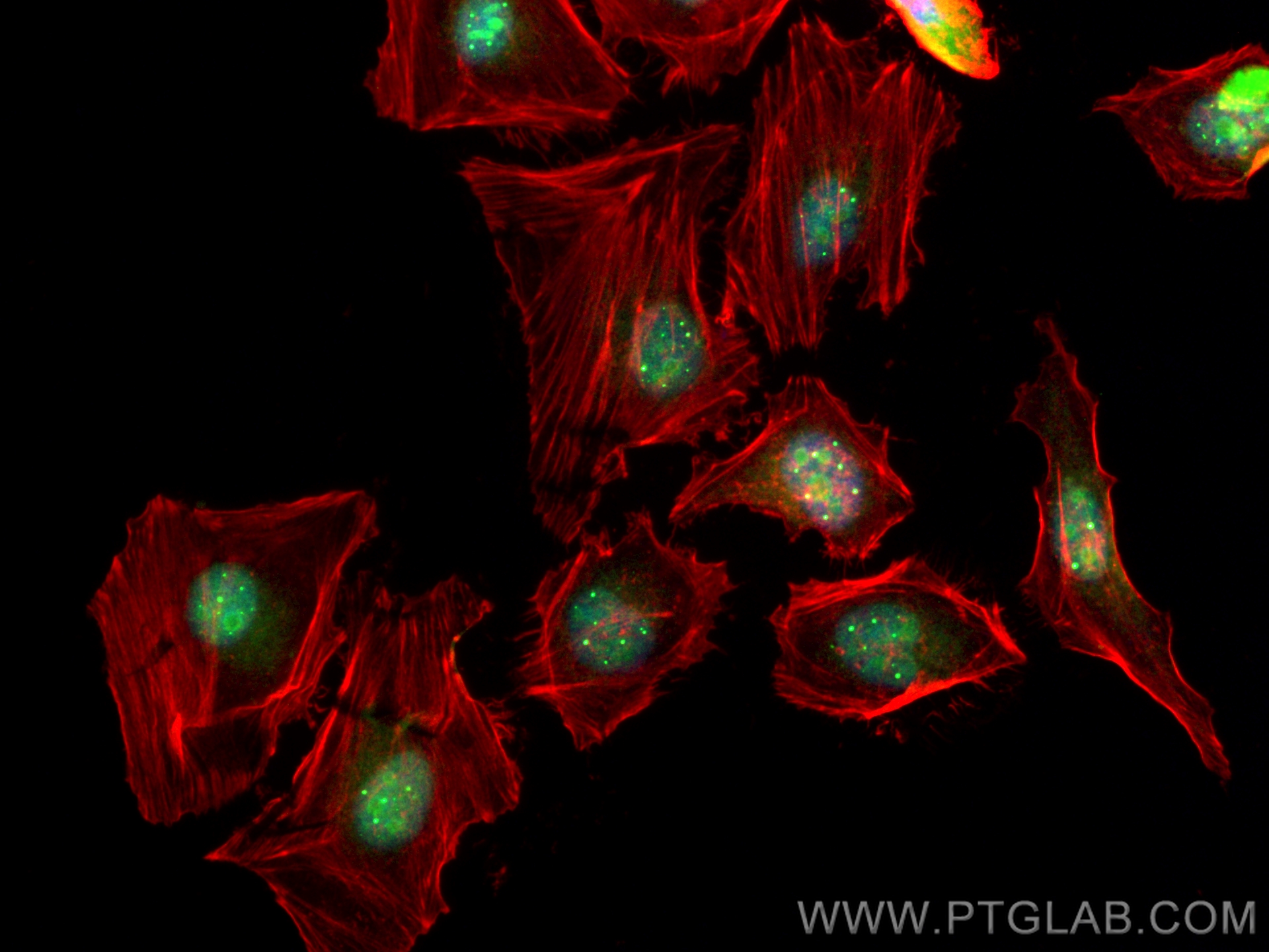 IF Staining of HeLa using CL488-16203