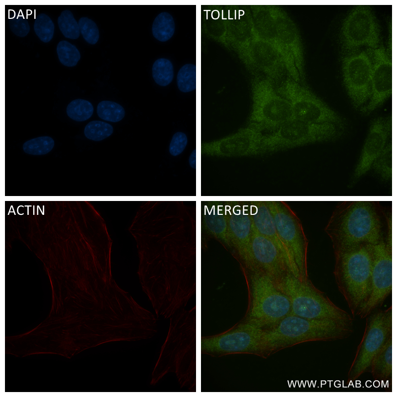 IF Staining of HepG2 using 84711-5-RR