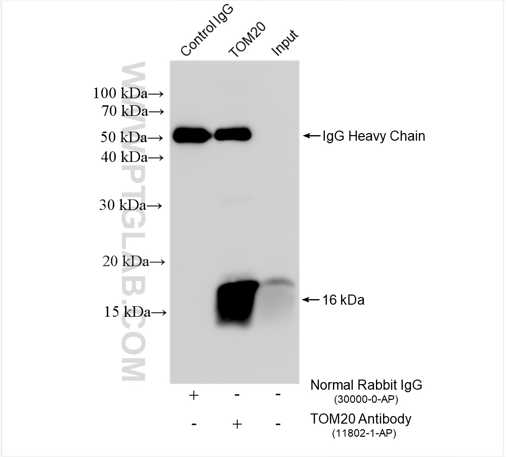 IP experiment of HeLa using 11802-1-AP