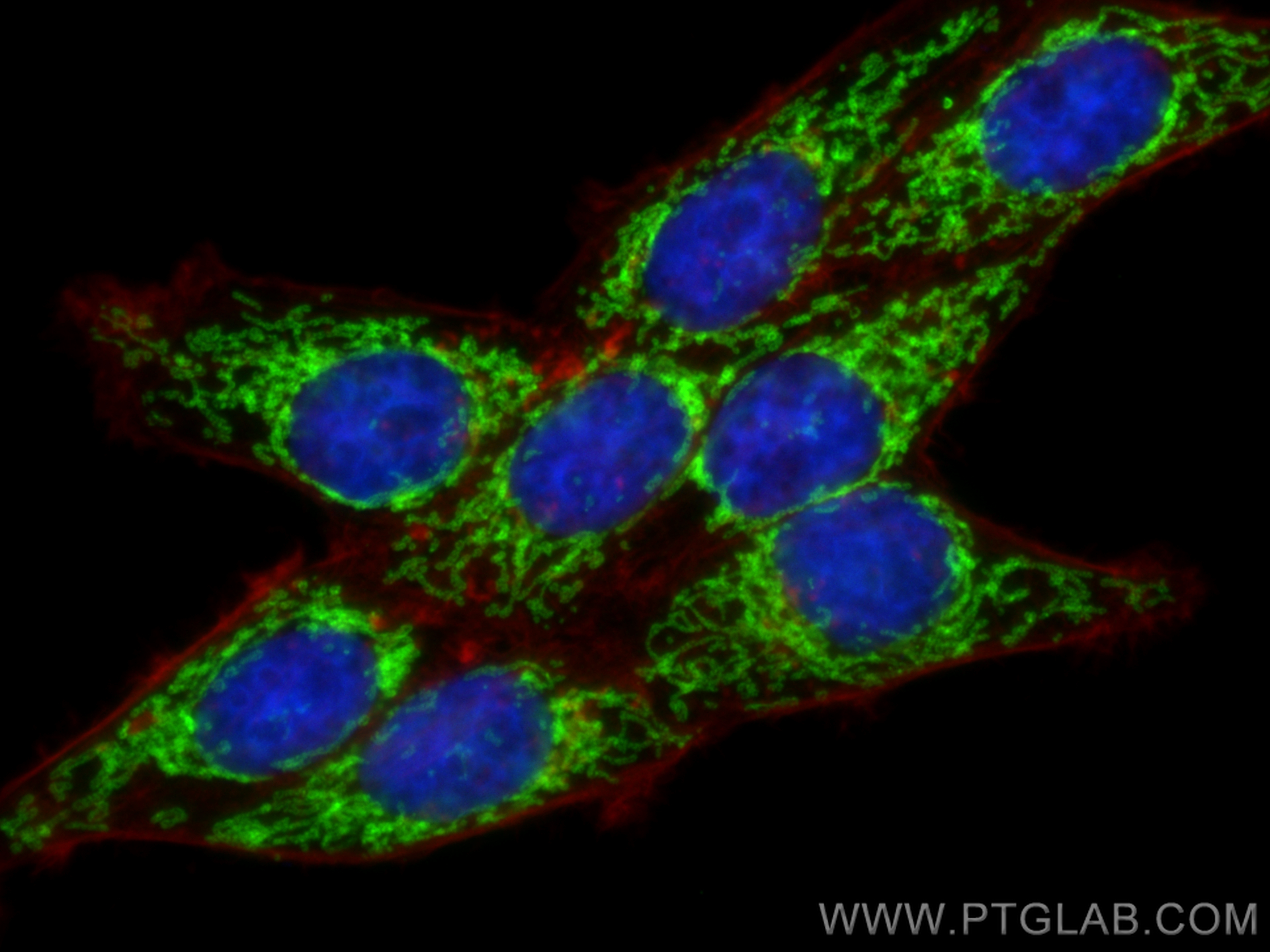 IF Staining of HepG2 using 11278-1-AP