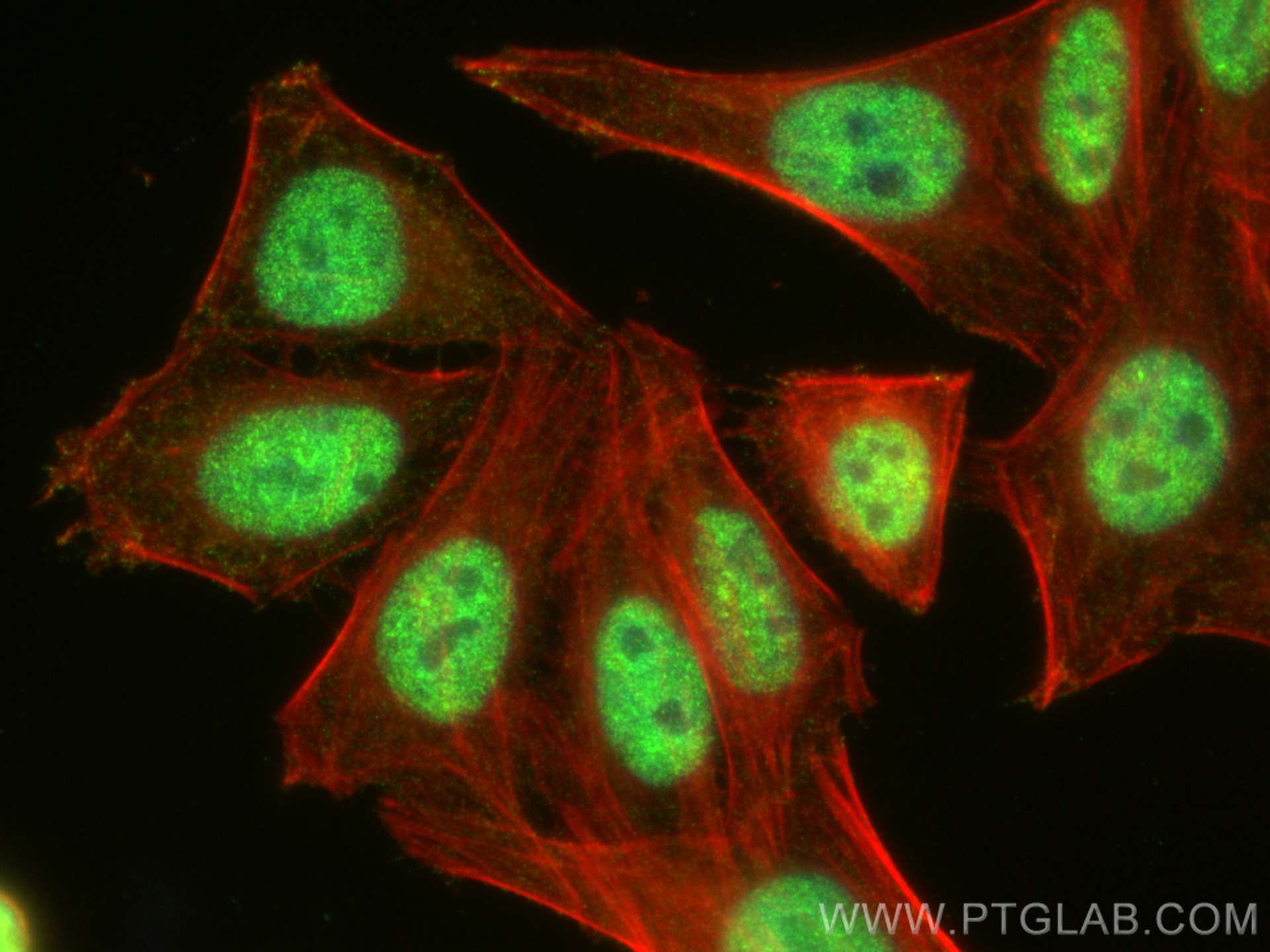 IF Staining of HepG2 using 20705-1-AP