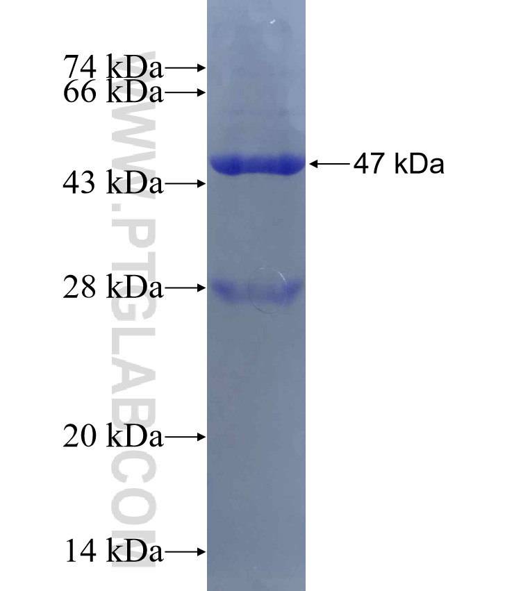 TOP3B fusion protein Ag14115 SDS-PAGE