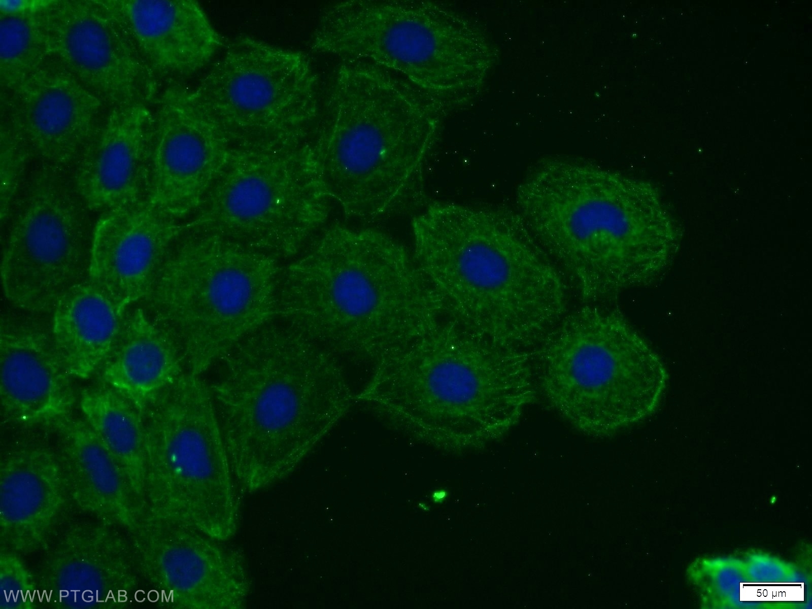 IF Staining of A431 using 24769-1-AP