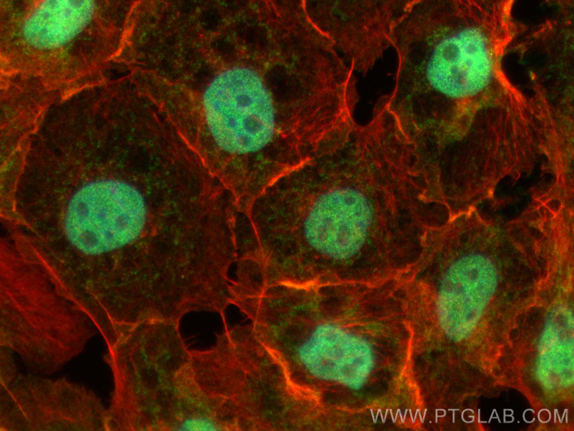 IF Staining of A431 using 30474-1-AP