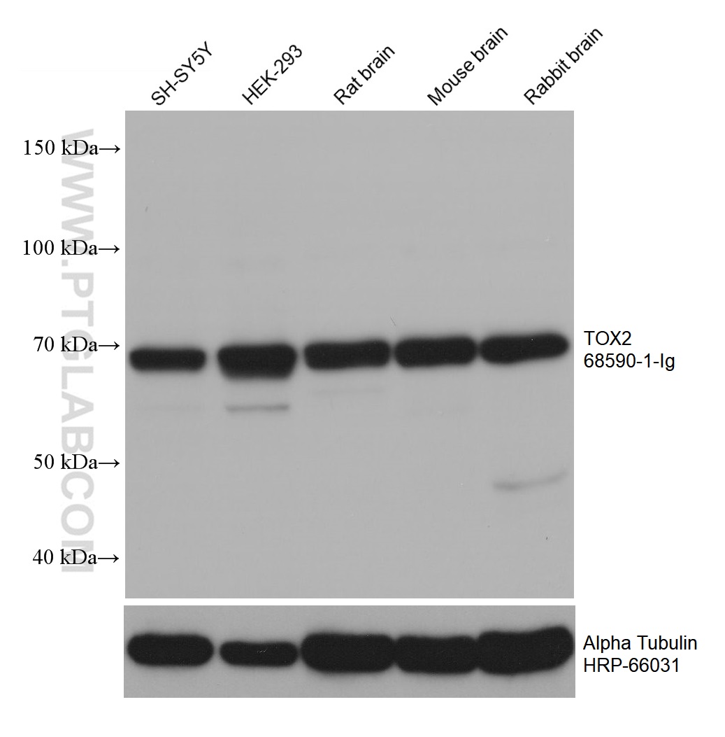 WB analysis using 68590-1-Ig (same clone as 68590-1-PBS)