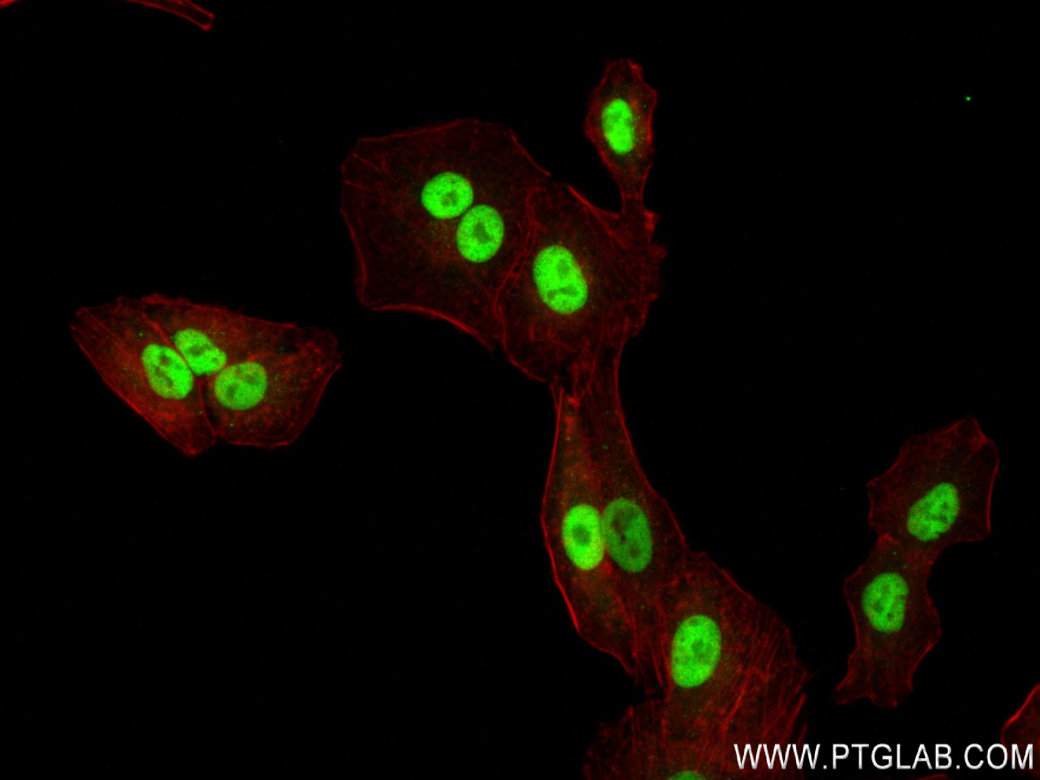 IF Staining of A549 using 84304-2-RR