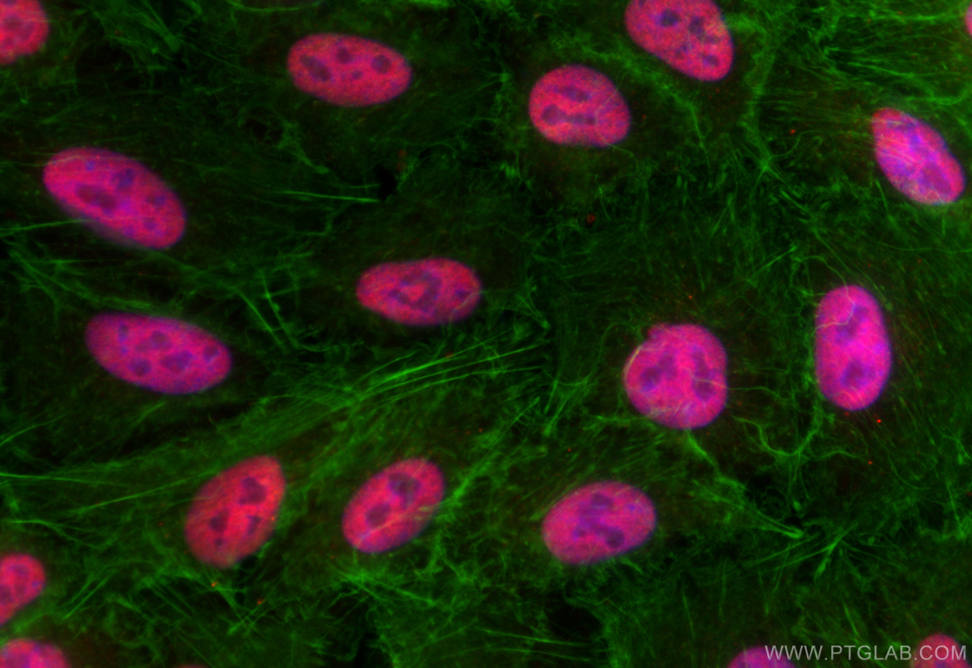 IF Staining of A549 using 84304-2-RR