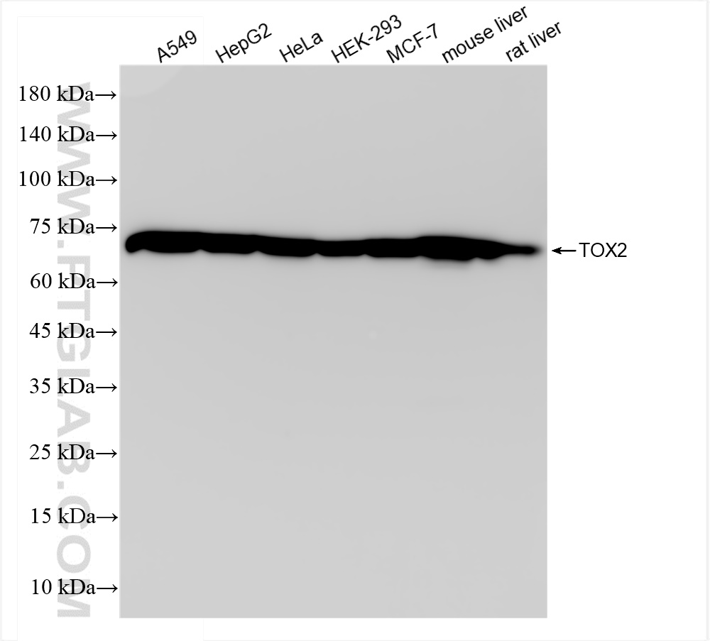 WB analysis using 84304-5-RR