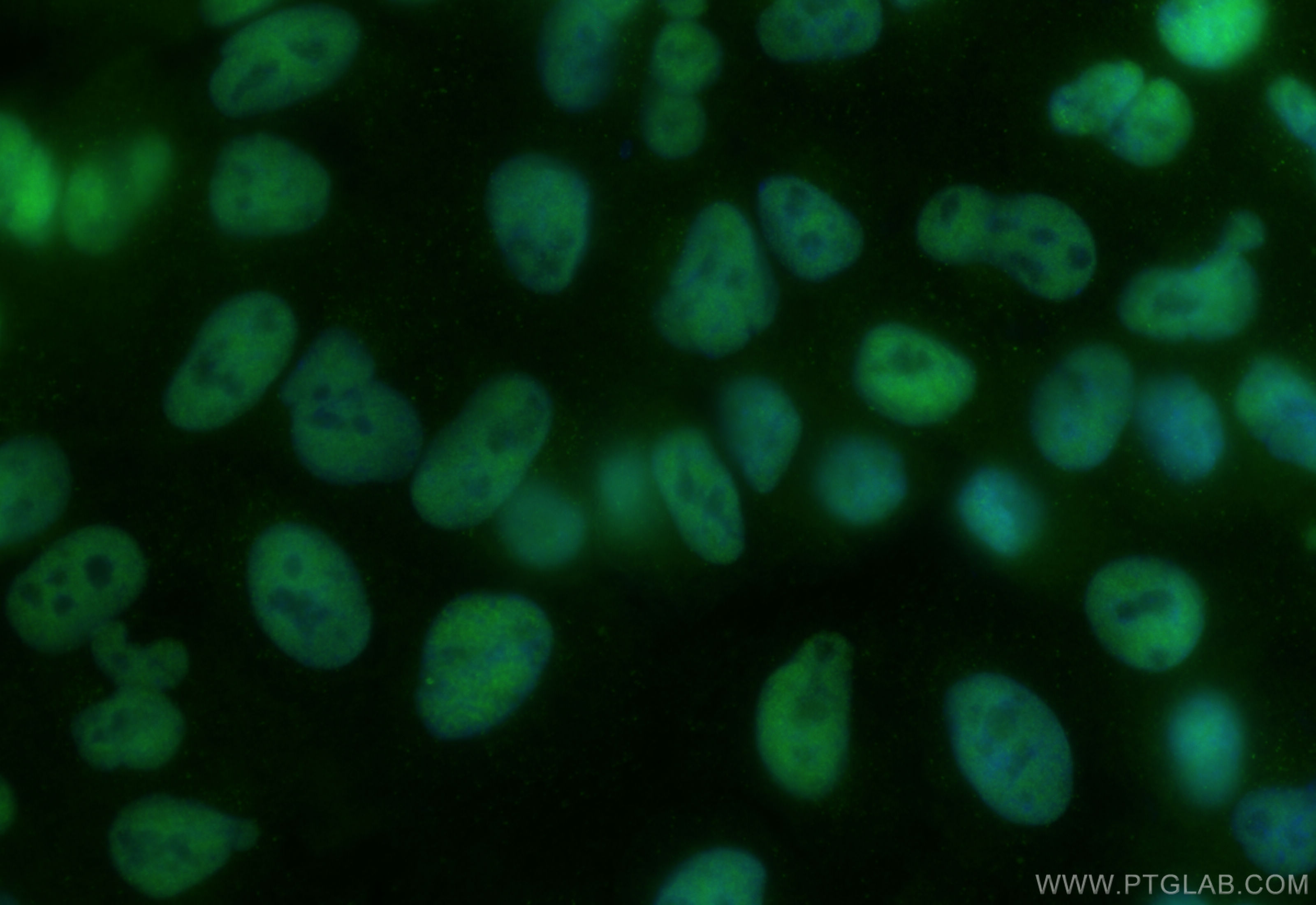 IF Staining of A549 using CL488-84304-2