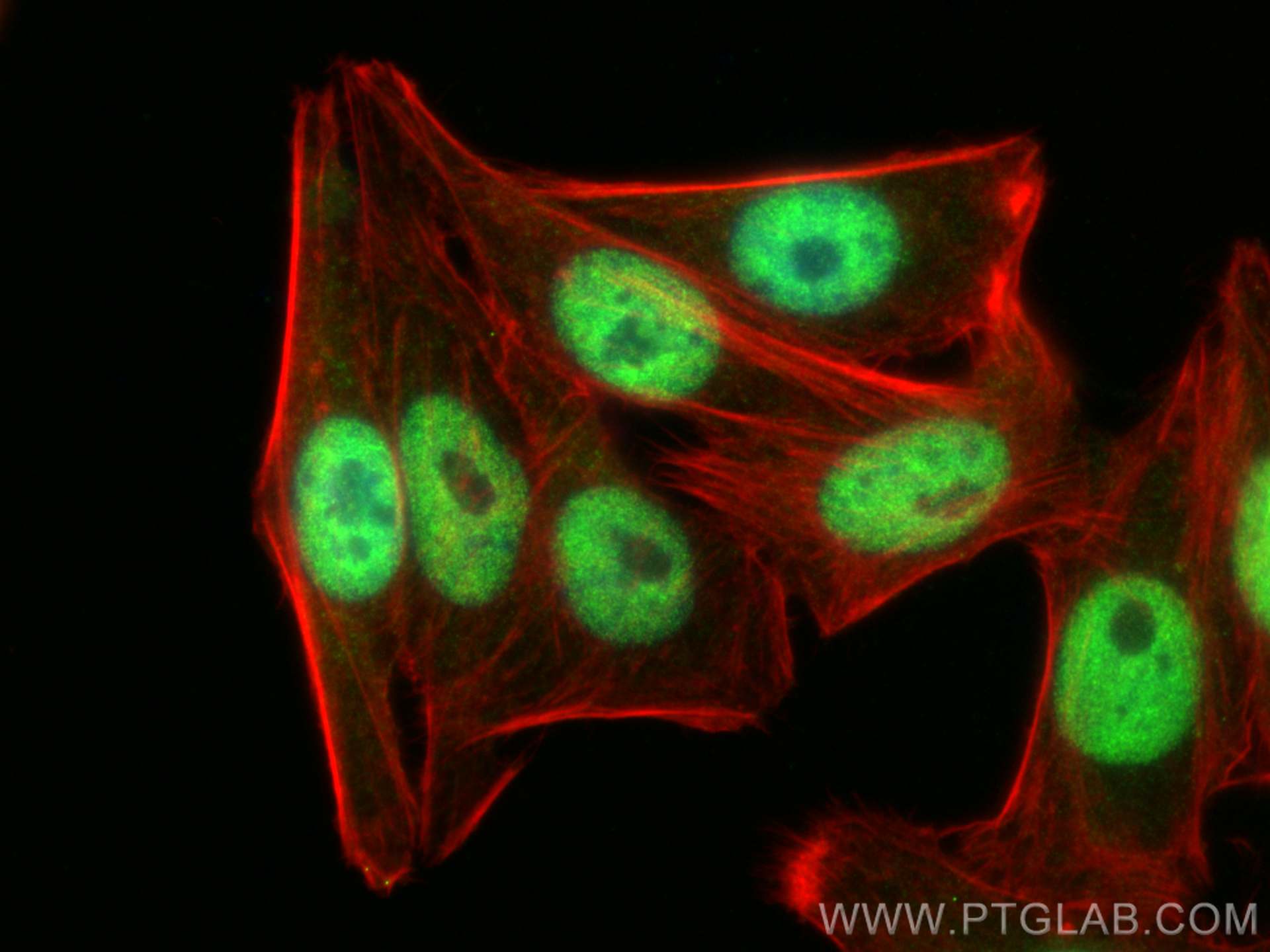 IF Staining of HepG2 using 27988-1-AP