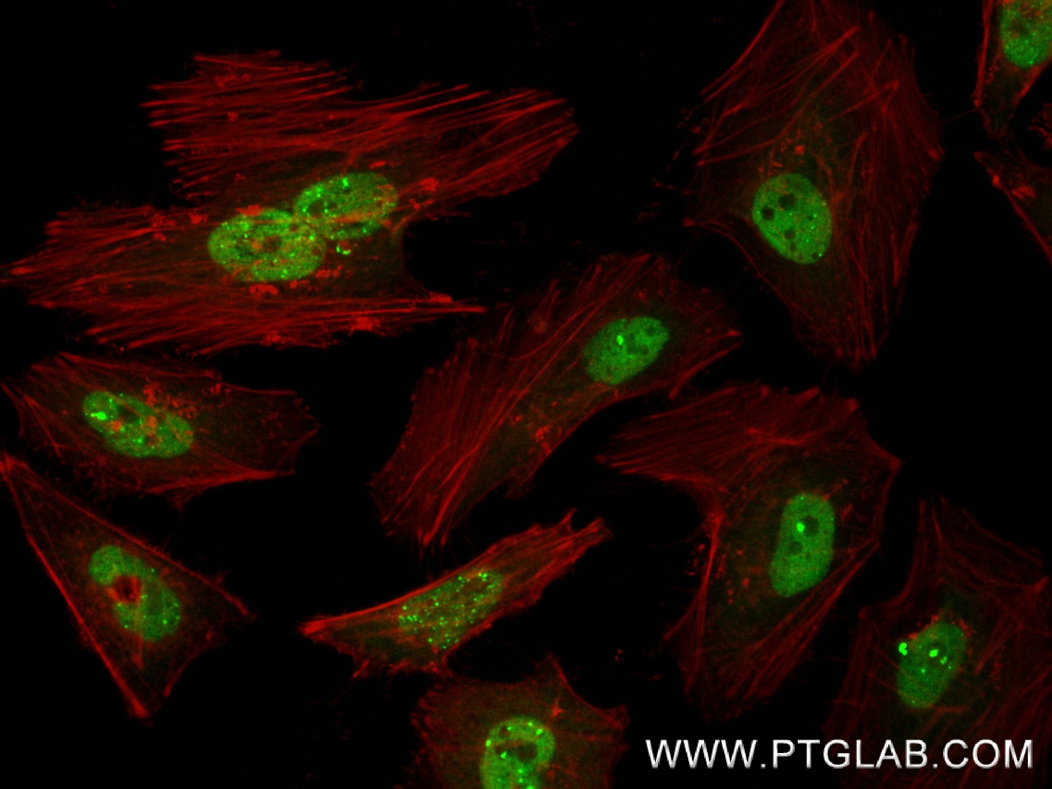 IF Staining of HeLa using 83809-1-RR