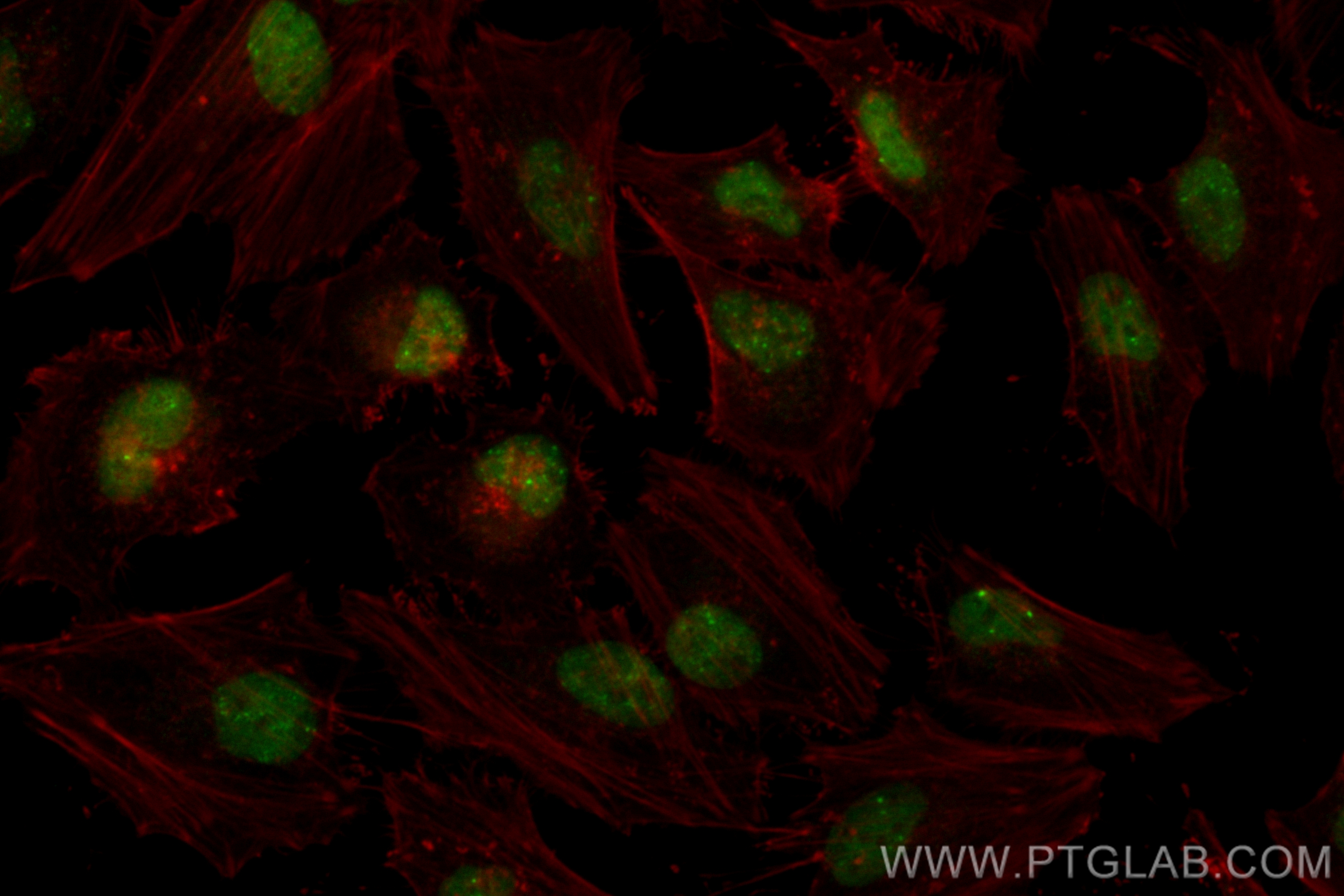 IF Staining of HeLa using CL488-83809