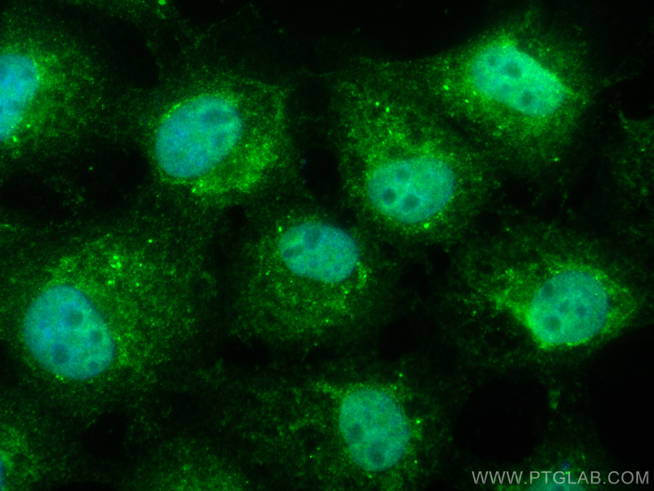 IF Staining of A431 using CL488-17872