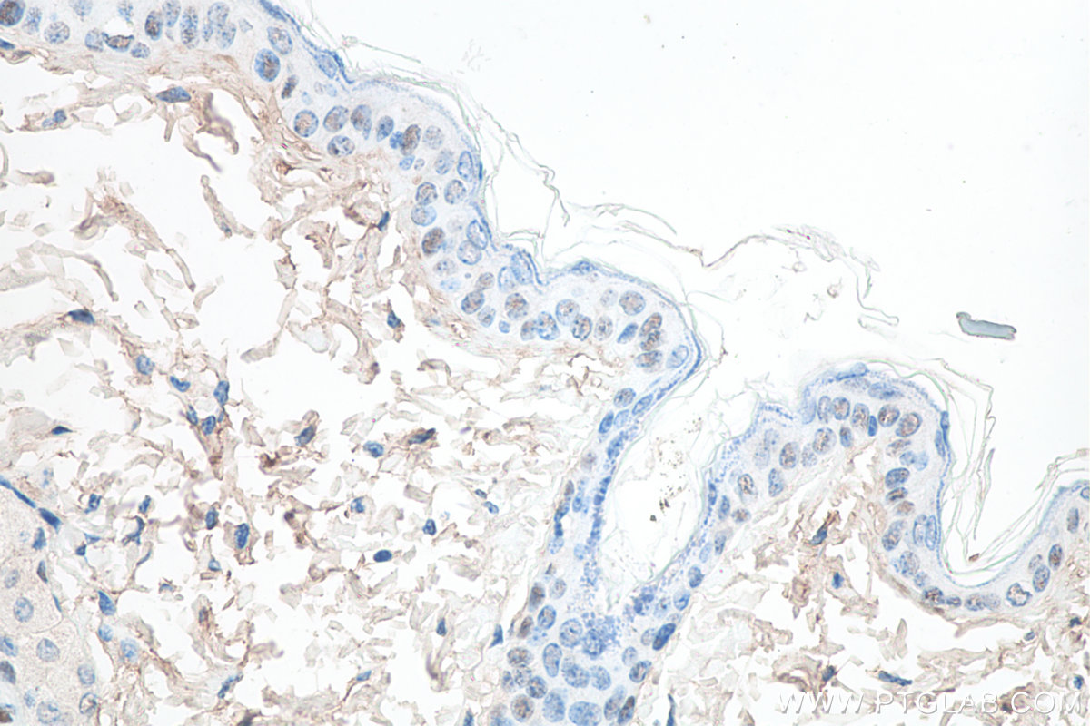 IHC staining of mouse skin using 60332-2-Ig (same clone as 60332-2-PBS)
