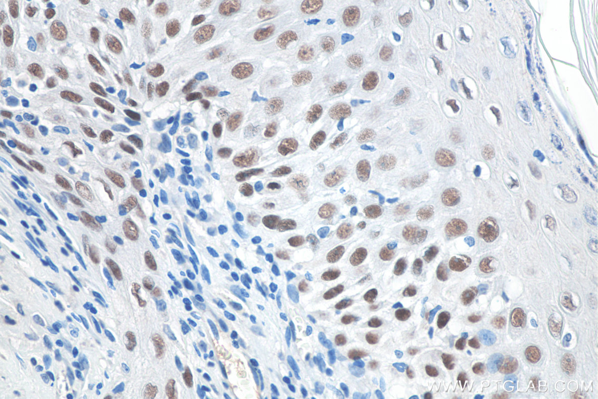 IHC staining of rat skin using 60332-2-Ig (same clone as 60332-2-PBS)